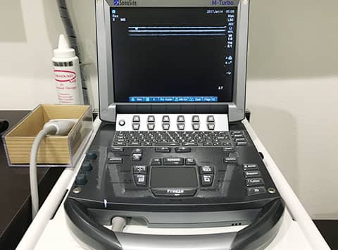 エコー検査(超音波画像診断器)